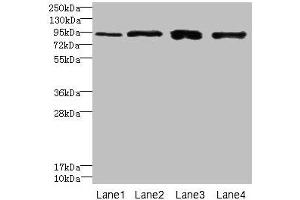 Western blot All lanes: XRRA1 antibody at 6 μg/mL Lane 1: HepG2 whole cell lysate Lane 2: Mouse kidney tissue Lane 3: HL60 whole cell lysate Lane 4: U251 whole cell lysate Secondary Goat polyclonal to rabbit IgG at 1/10000 dilution Predicted band size: 90, 68, 89, 84, 59 kDa Observed band size: 90 kDa (XRRA1 Antikörper  (AA 101-400))