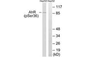 Western blot analysis of extracts from HepG2 cells, using AhR (Phospho-Ser36) Antibody. (Aryl Hydrocarbon Receptor Antikörper  (pSer36))