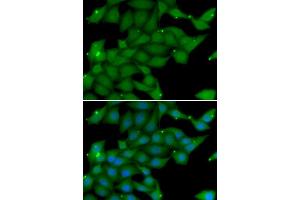 Immunofluorescence analysis of U20S cell using RASGRF1 antibody. (RASGRF1 Antikörper)