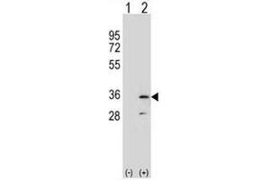 Western blot analysis of RPA2 (arrow) using rabbit polyclonal RPA2 Antibody (N-term) . (RPA2 Antikörper  (N-Term))