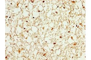 Immunohistochemistry (IHC) image for anti-WAS Protein Family, Member 3 (WASF3) (AA 368-502) antibody (ABIN7175838)