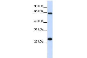 Karyopherin Alpha 1 antibody used at 1 ug/ml to detect target protein. (KPNA1 Antikörper)
