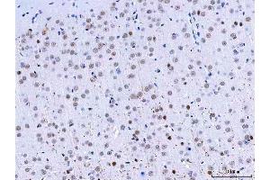 IHC analysis of HnRNP H/HNRNPH1 using anti-HnRNP H/HNRNPH1 antibody (ABIN4886623).