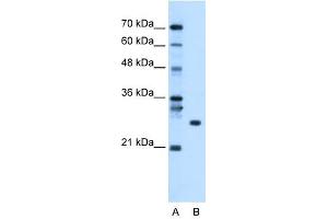 RBPMS antibody used at 1. (RBPMS Antikörper  (N-Term))