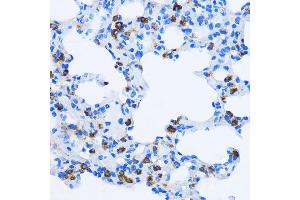 Immunohistochemistry of paraffin-embedded Rat lung using EE antibody  at dilution of 1:100 (40x lens). (EEA1 Antikörper  (AA 1182-1411))