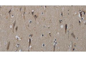 Immunohistochemistry of paraffin-embedded Human brain tissue using HSPG2 Polyclonal Antibody at dilution 1:50 (HSPG2 Antikörper)