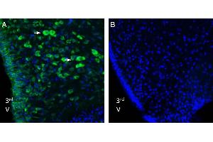 Expression of Nucleobindin-2/Nesfatin-1 in rat hypothalmus. (Nucleobindin 2 (NUCB2) Peptid)