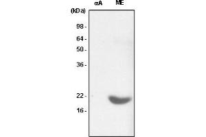 Western Blotting (WB) image for anti-Crystallin, alpha B (CRYAB) (AA 1-175) antibody (ABIN6245677) (CRYAB Antikörper  (AA 1-175))