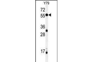 Western blot analysis of NOB1 Antibody (C-term) (ABIN651015 and ABIN2840039) in Y79 cell line lysates (35 μg/lane). (NOB1 Antikörper  (C-Term))