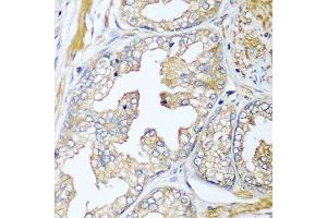 Immunohistochemistry of paraffin-embedded human prostate using CFD antibody. (Adipsin Antikörper  (AA 26-253))