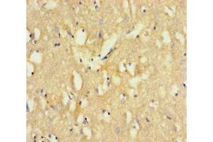 Immunohistochemistry of paraffin-embedded human brain tissue using ABIN7171199 at dilution of 1:100