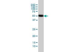 CANT1 monoclonal antibody (M01), clone 2D3 Western Blot analysis of CANT1 expression in A-431 . (CANT1 Antikörper  (AA 302-401))