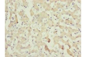 Immunohistochemistry of paraffin-embedded human liver tissue using ABIN7148369 at dilution of 1:100 (C8A Antikörper  (AA 310-460))