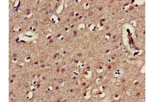 Immunohistochemistry (IHC) image for anti-Killer Cell Immunoglobulin-Like Receptor, three Domains, Long Cytoplasmic Tail, 1 (KIR3DL1) (AA 81-336) antibody (ABIN7157524)