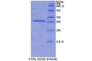 SDS-PAGE (SDS) image for Axin 1 (AXIN1) (AA 654-863) protein (His tag) (ABIN2124103) (Axin Protein (AA 654-863) (His tag))