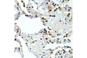 Immunohistochemistry of paraffin-embedded human normal lung using GTF2F1 antibody. (GTF2F1 Antikörper)