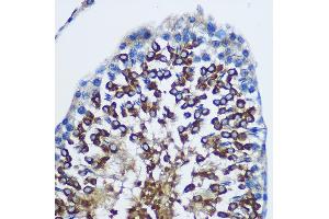Immunohistochemistry of paraffin-embedded Rat testis using ST Rabbit pAb (ABIN1682908, ABIN1682909, ABIN5664112 and ABIN6219730) at dilution of 1:100 (40x lens). (STAT4 Antikörper  (AA 600-700))