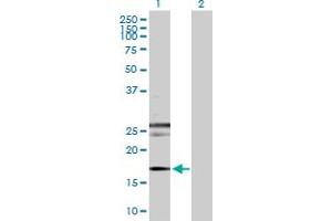 Western Blot analysis of RHEB expression in transfected 293T cell line by RHEB MaxPab polyclonal antibody. (RHEB Antikörper  (AA 1-184))