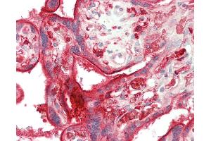 Human Placenta: Formalin-Fixed, Paraffin-Embedded (FFPE) (DAB2 Antikörper  (AA 743-770))