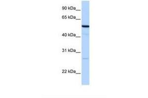 Image no. 1 for anti-Receptor Accessory Protein 4 (REEP4) (AA 67-116) antibody (ABIN6738648) (Receptor Accessory Protein 4 Antikörper  (AA 67-116))