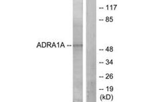 Western blot analysis of extracts from lOVO cells, using ADRA1A Antibody.