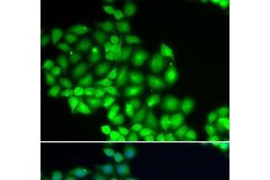 Immunofluorescence analysis of HeLa cells using ERCC2 Polyclonal Antibody (ERCC2 Antikörper)