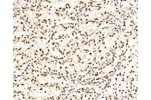 IHC analysis of DBC-1/CCAR2 using anti-DBC-1/CCAR2 antibody (ABIN7602235).