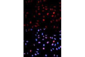 Immunofluorescence (IF) image for anti-Tumor Protein P53 (TP53) (pSer15) antibody (ABIN1870674) (p53 Antikörper  (pSer15))