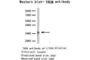 Western Blotting (WB) image for anti-Triggering Receptor Expressed On Myeloid Cells 1 (TREM1) antibody (ABIN1875201) (TREM1 Antikörper)