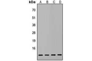 Western blot analysis of ATP5L2 expression in HepG2 (A), PC3 (B), MCF7 (C), NIH3T3 (D) whole cell lysates. (ATP5L2 Antikörper  (Center))