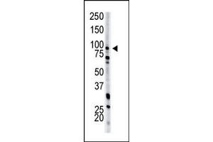 Image no. 1 for anti-phosphofructokinase, Muscle (PFKM) (N-Term) antibody (ABIN360632)