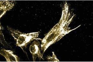 Immunofluoresence staining of human fibroblasts.