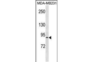 Western blot analysis in MDA-MB231 cell line lysates (35ug/lane). (KIRREL Antikörper  (C-Term))