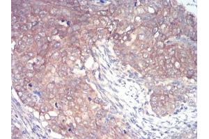 Immunohistochemistry (IHC) image for anti-Interleukin-1 Receptor-Associated Kinase 3 (IRAK3) (AA 454-596) antibody (ABIN5542522)