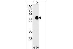 Western blot analysis of PXN(arrow) using rabbit polyclonal PXN Antibody  (ABIN390376 and ABIN2840778). (Paxillin Antikörper  (AA 94-125))