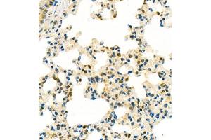 Immunohistochemistry (Paraffin-embedded Sections) (IHC (p)) image for anti-Prothymosin, alpha (PTMA) antibody (ABIN7075306)