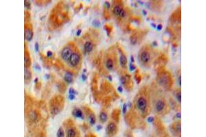 Used in DAB staining on fromalin fixed paraffin-embedded Liver tissue (Laminin alpha 5 Antikörper  (AA 3517-3718))
