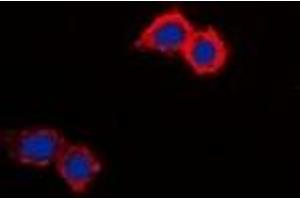 Immunofluorescent analysis of NHE8 staining in HepG2 cells.