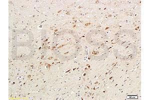 Formalin-fixed and paraffin embedded rat brain labeled with Anti-ChAT Polyclonal Antibody, Unconjugated (ABIN724070) 1:200followed by conjugation to the secondary antibody and DAB staining (Choline Acetyltransferase Antikörper  (AA 101-200))
