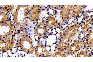 Detection of PRLR in Rat Kidney Tissue using Polyclonal Antibody to Prolactin Receptor (PRLR) (Prolactin Receptor Antikörper  (AA 20-229))