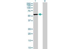 Western Blot analysis of CAP1 expression in transfected 293T cell line by CAP1 MaxPab polyclonal antibody. (CAP1 Antikörper  (AA 1-475))