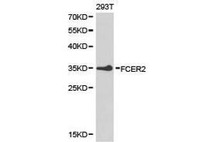 Western Blotting (WB) image for anti-Fc Fragment of IgE, Low Affinity II, Receptor For (CD23) (FCER2) antibody (ABIN1872669) (FCER2 Antikörper)