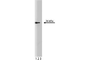 Western blot analysis of Bcl-x on human endothelial cell lysate. (BCL2L1 Antikörper  (AA 18-233))