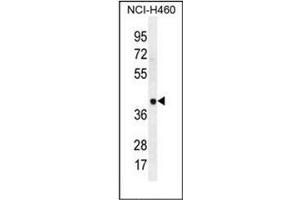 Western blot analysis of LRRC38 Antibody (C-term) in NCI-H460 cell line lysates (35ug/lane). (LRRC38 Antikörper  (C-Term))