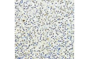 Immunohistochemistry of paraffin-embedded human tonsil using Phospho-Histone H3-T32 antibody (ABIN7267691) at dilution of 1:100 (40x lens).