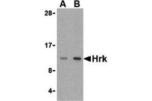 Western Blotting (WB) image for anti-Harakiri, BCL2 Interacting Protein (Contains Only BH3 Domain) (HRK) (Middle Region) antibody (ABIN1030949) (HRK Antikörper  (Middle Region))