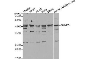 Western Blotting (WB) image for anti-SMYD Family Member 5 (SMYD5) antibody (ABIN1882323) (SMYD5 Antikörper)
