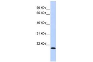 Image no. 1 for anti-Interferon Regulatory Factor 7 (IRF7) (AA 35-84) antibody (ABIN6742766) (IRF7 Antikörper  (AA 35-84))