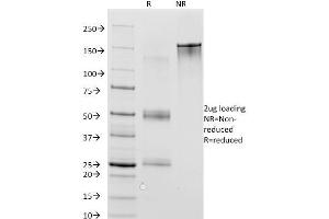 SDS-PAGE (SDS) image for anti-Melanoma Antigen Family A, 1 (Directs Expression of Antigen MZ2-E) (MAGEA1) antibody (ABIN6940000)