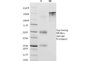 SDS-PAGE Analysis Purified MAGE-1 Mouse Monoclonal Antibody (MA454). (MAGEA1 Antikörper)